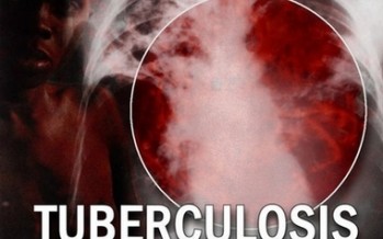 10,500 people die from tuberculosis every year in Afghanistan