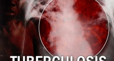 10,500 people die from tuberculosis every year in Afghanistan