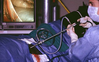 Isteqlal Hospital in Kabul city now offers laparoscopic surgery
